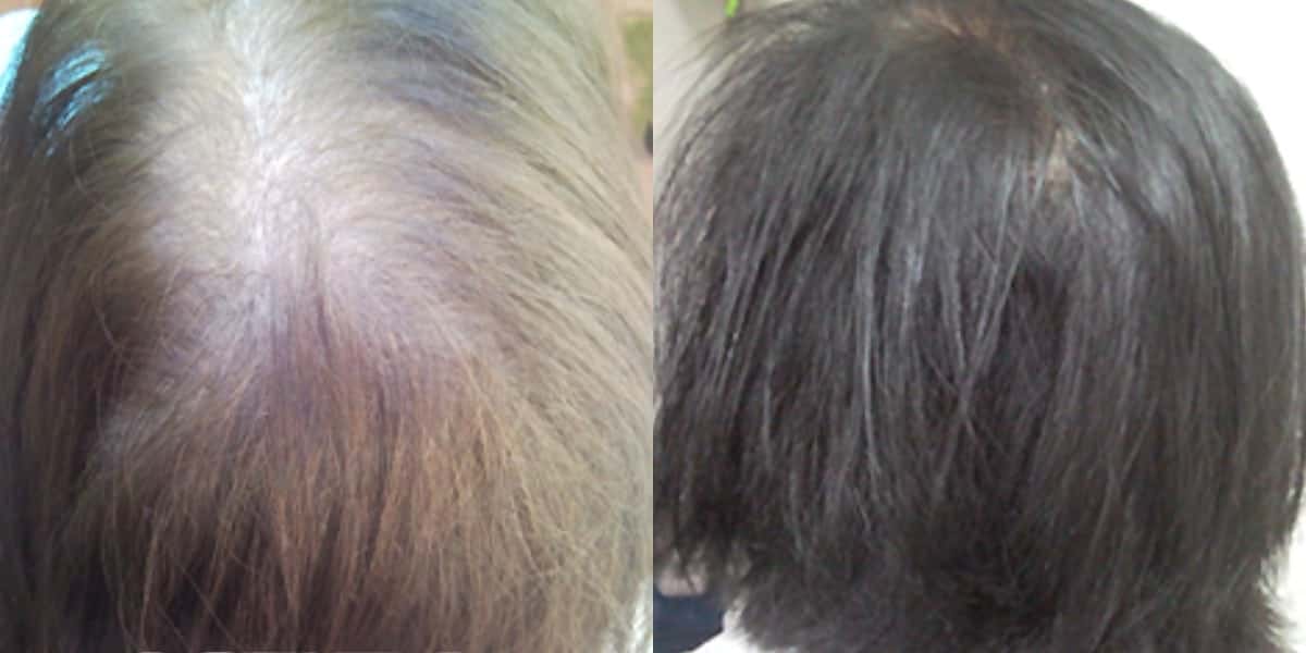 Cabelos brancos antes e depois (Foto: Divulgação)
