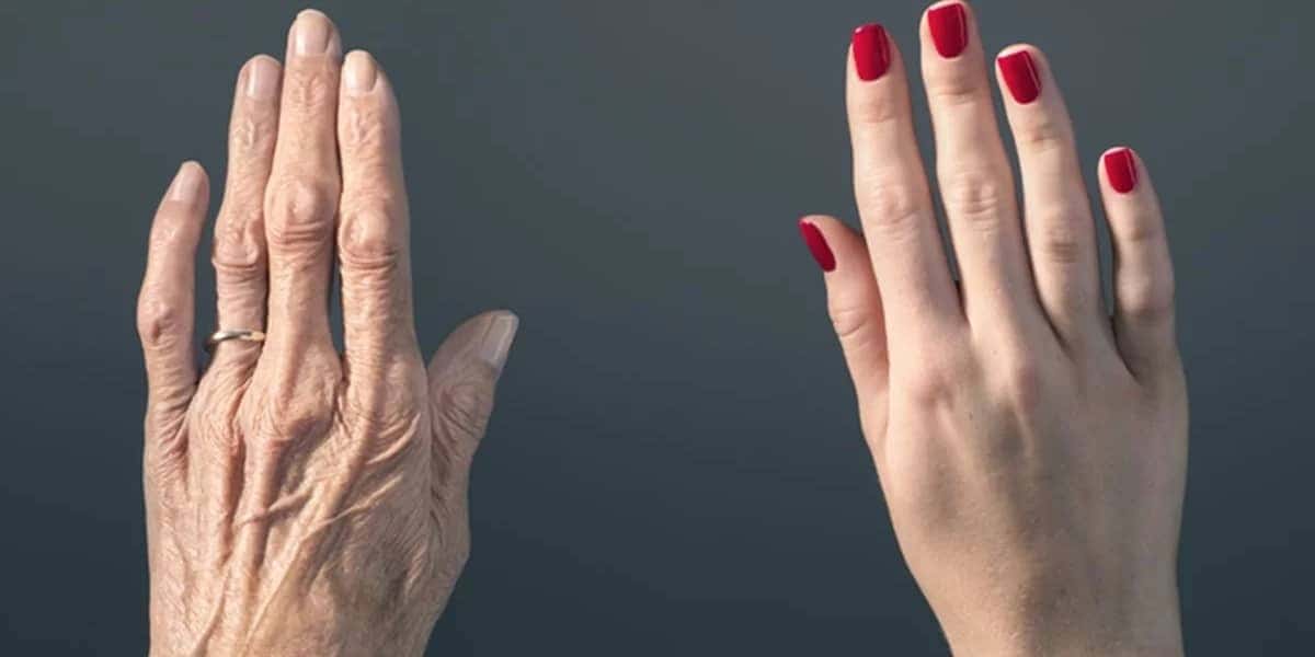Mãos sem e com hidratação (Foto: Reprodução/ Internet)