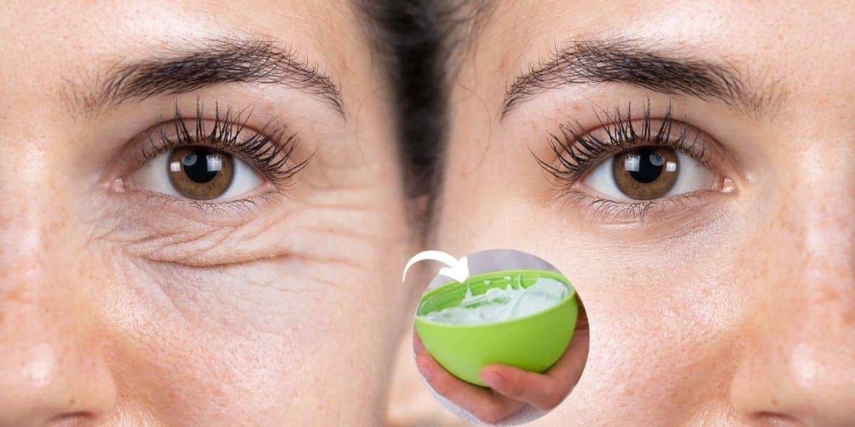 Conheça essas receitas incríveis contra as rugas, varizes e até rachaduras (Foto: Internet)