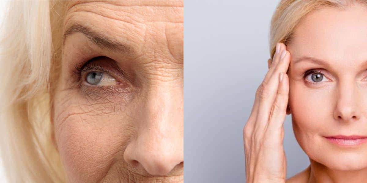 9 óleos para acabar com as rugas, melhor que botox (Reprodução: Montagem TV Foco)