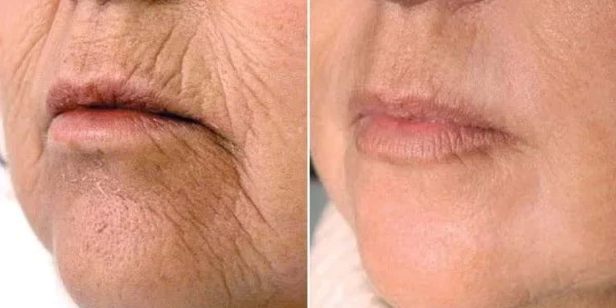 Receitinha com 5 ingredientes rejuvenesce a pele de mulheres 40+ - (Foto: Reprodução / Internet)
