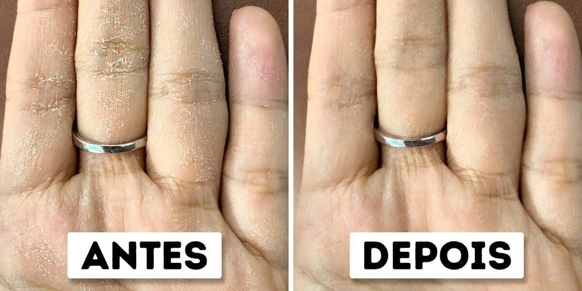 Receita mágica para cuidar das mãos ressecadas (Foto: Reprodução/ Internet)