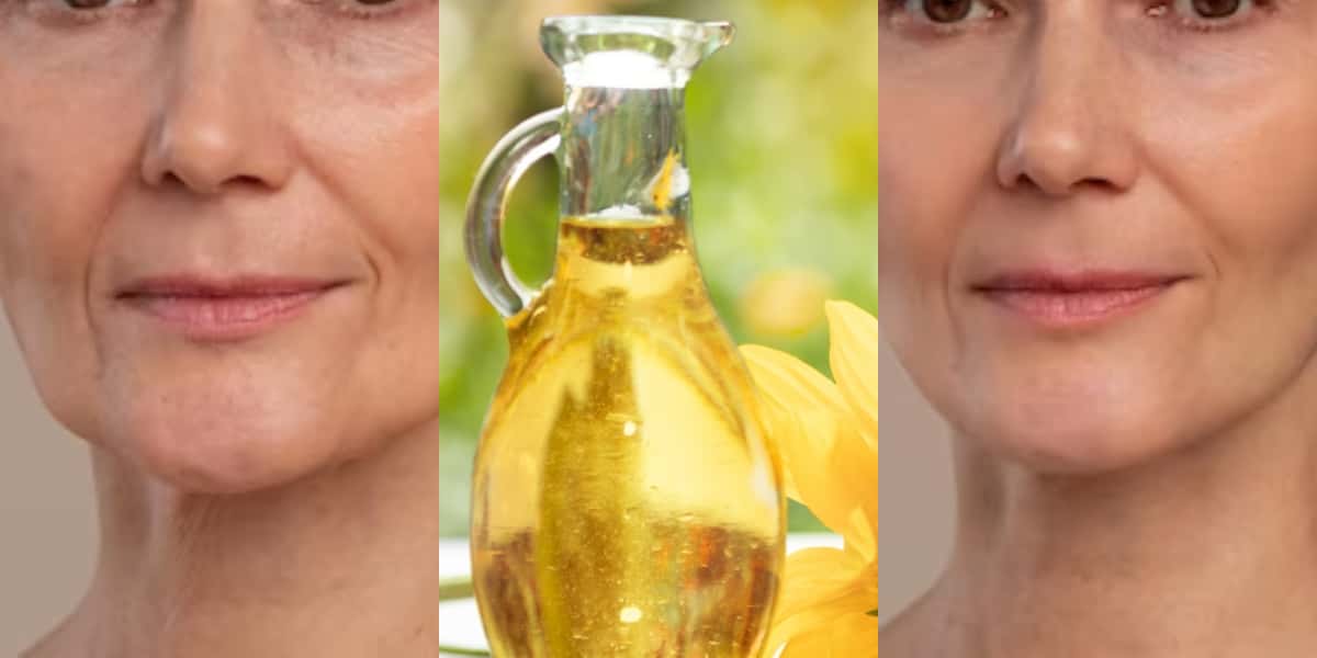 Tratamento com óleos acabam com rugas (Foto: Divulgação)