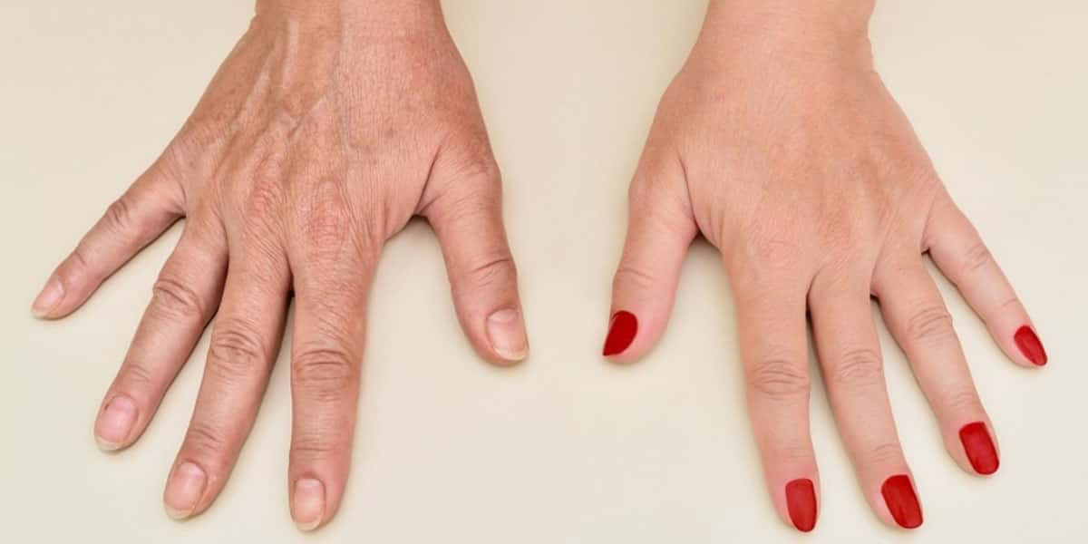 Antes e Depois de mãos (Foto: Reprodução - Freepick)