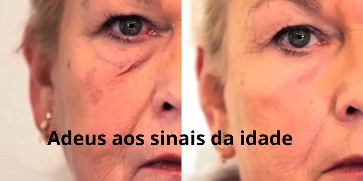 $ segredos que vão acabar com o sinal da idade (Reprodução: Montagem TV Foco)