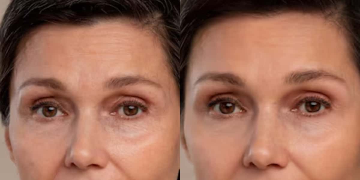 Receitinha caseira acaba com rugas em senhoras (Foto: Divulgação)