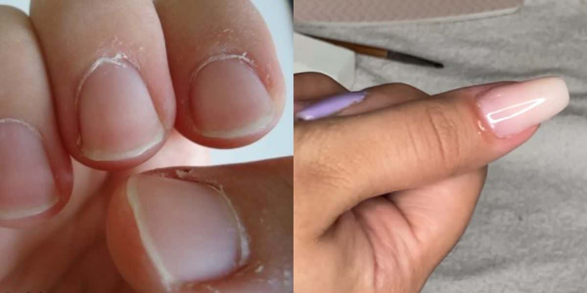 Unha de gel caseira deixará sua mão impecável (Reprodução: Montagem TV Foco)
