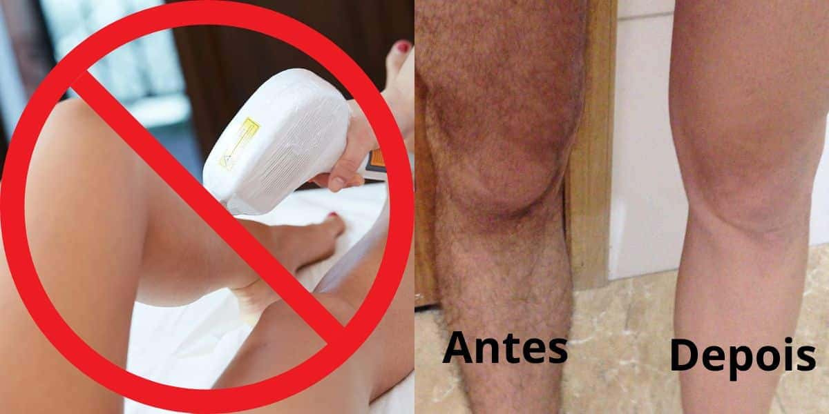 Mistura Maracujá acaba com os pelos e deixa sua pele assim (Reprodução: Montagem TV Foco)
