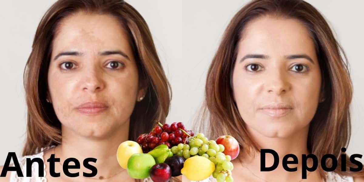 Deixe sua pele livre de manchas com essas 2 frutas (Reprodução: Montagem TV Foco)