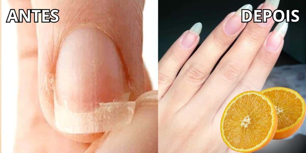 Conheça essa receita caseira incrível para ter unhas mais longas (Foto: Internet)