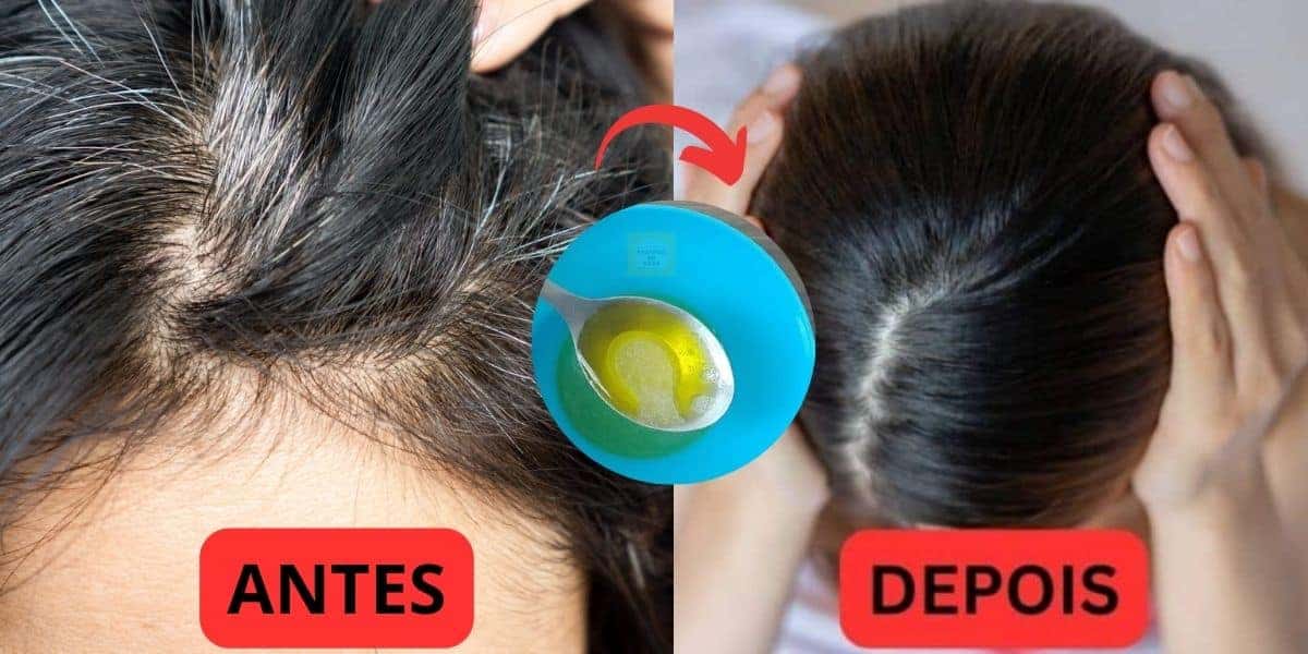 Receitinha natural acaba com os cabelos brancos (Foto: Internet)