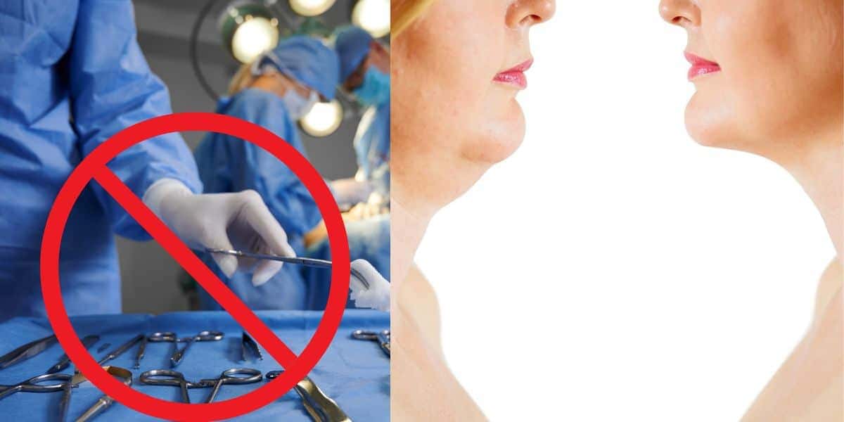 Dê fim a papada sem precisar passar plástica (Reprodução: Montagem TV Foco)