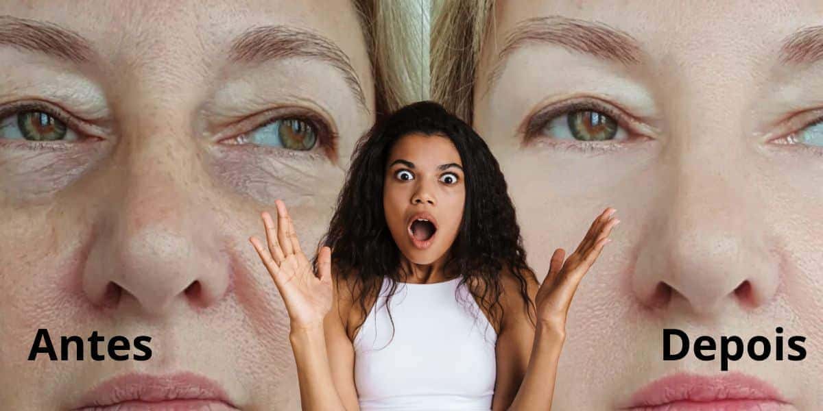 Dê adeus às rugas com uma harmonização facial caseira (Reprodução: Montagem TV Foco)