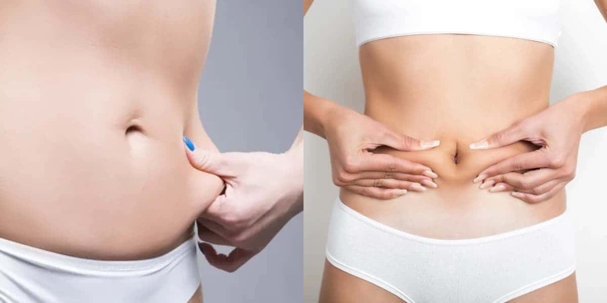 Adeus a barriga flácida com essa receita (Foto: Montagem TV Foco)