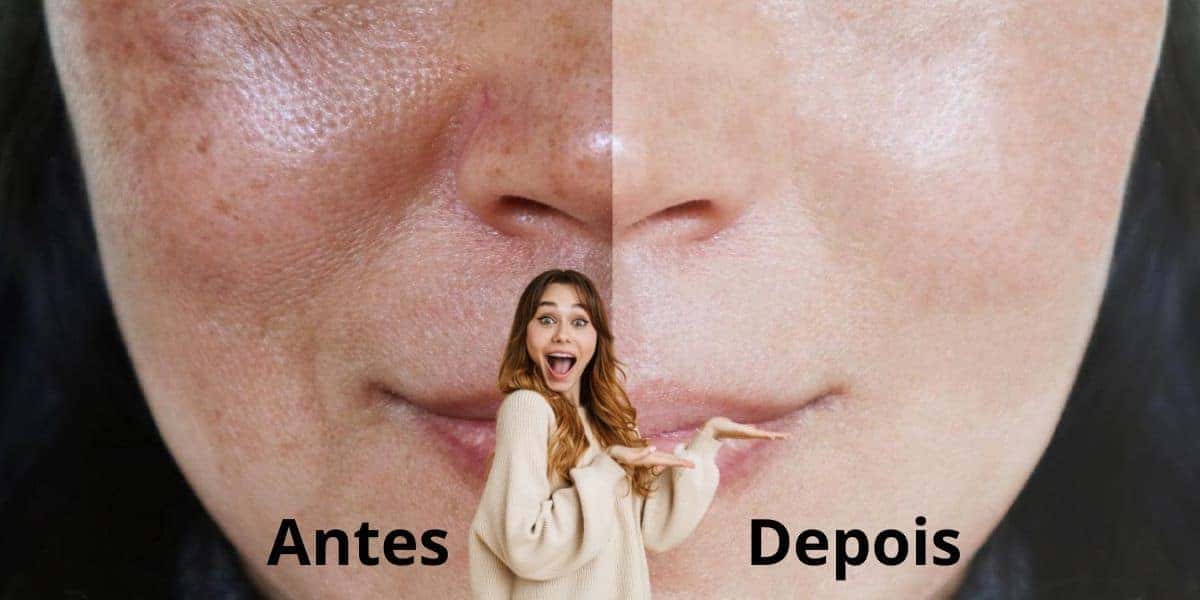 Acabe com as manchas da pele com 2 ingredientes (Reprodução: Montagem TV Foco)