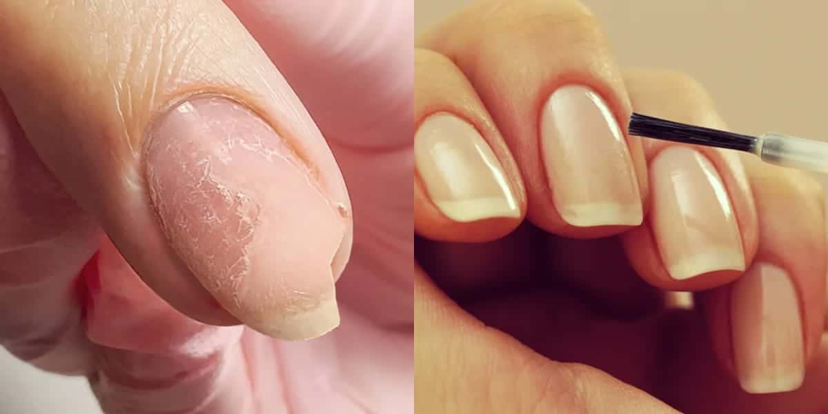 Unhas quebradiças e unhas perfeitas (Foto: Reprodução/ Internet)