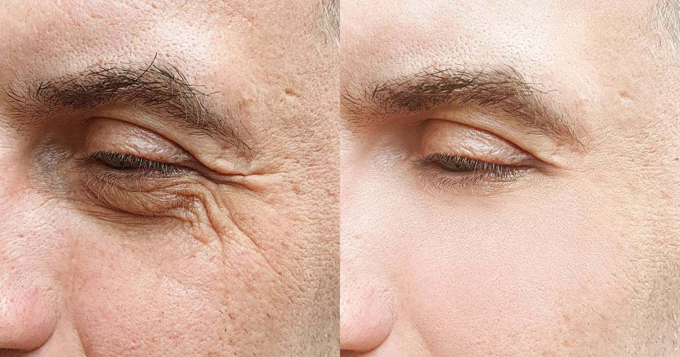 Receita caseira com 2 ingredientes rejuvenesce a pele (Foto: Divulgação)