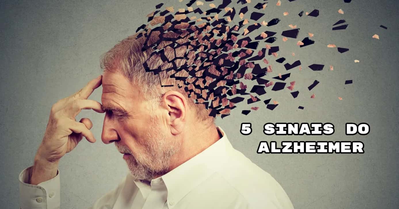 Esses são os 5 sinais que indicam que você pode ter alzheimer (Foto: iStock/Getty Images)