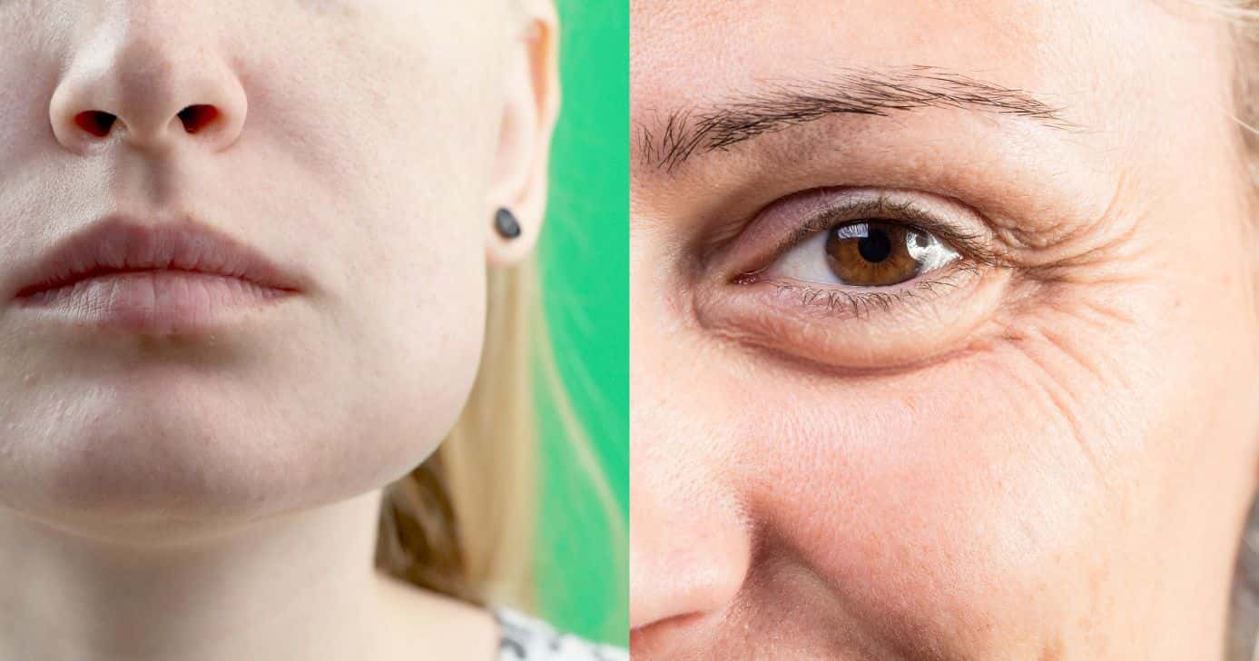 Peeling suga rugas (Reprodução/Montagem TV Foco/Canva)