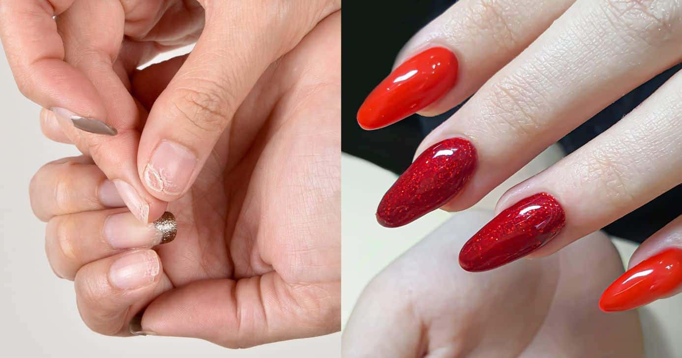 Unhas quebradas e grandes (Fotos: Canva)