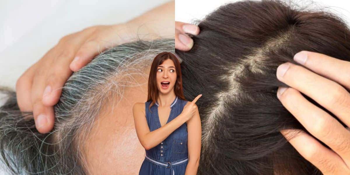 Matizador natural para escurecer o cabelo branco (Reprodução: Montagem TV Foco)