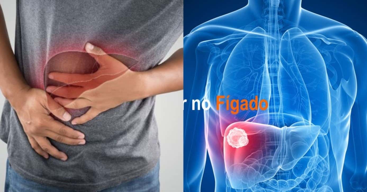 Confirmado motivo nº1 para diagnóstico de câncer de fígado com alerta máximo aos 60+ - Foto: Internet