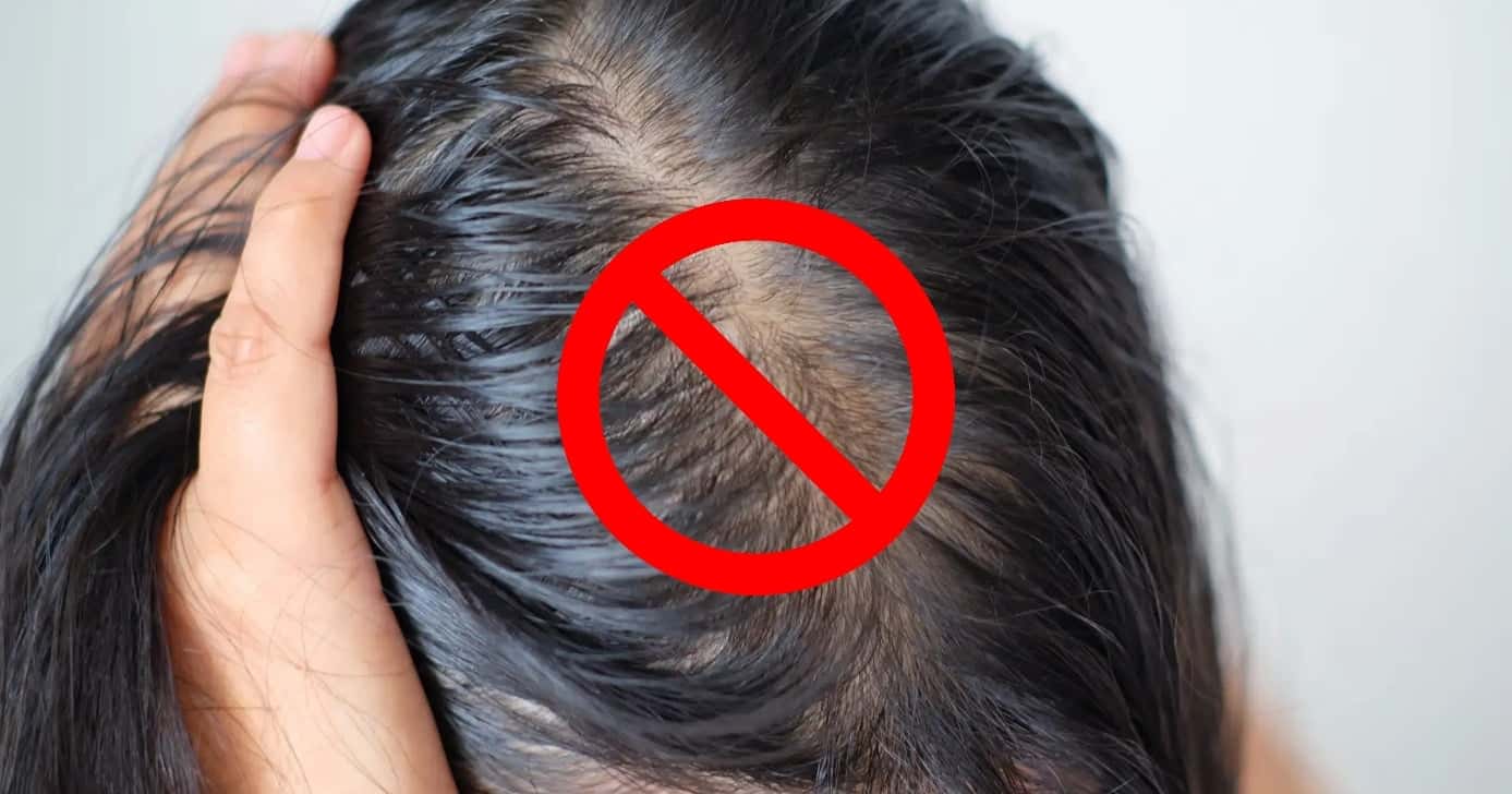É possível dizer adeus ao cabelo oleoso com esses 5 ingredientes (Foto: Montagem)