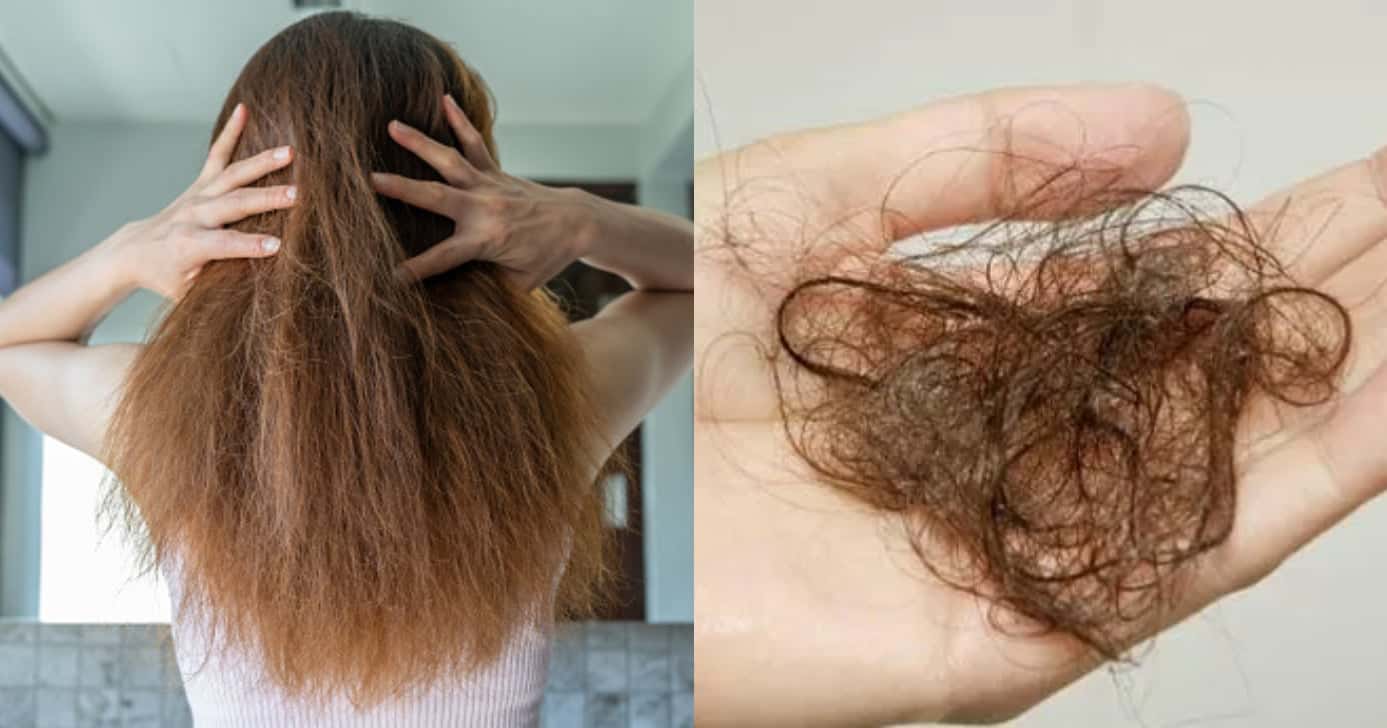 Queda de cabelo ao usar canetas para emagrecer: Especialista ensina como diminuir (Foto: Montagem)