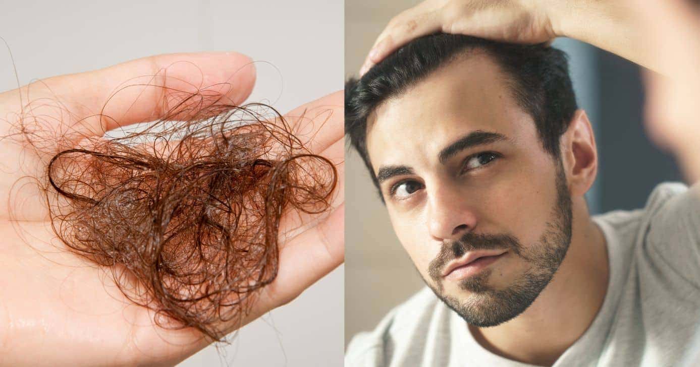 Técnica natural ajuda a diminuir queda de cabelo (Foto: Divulgação)