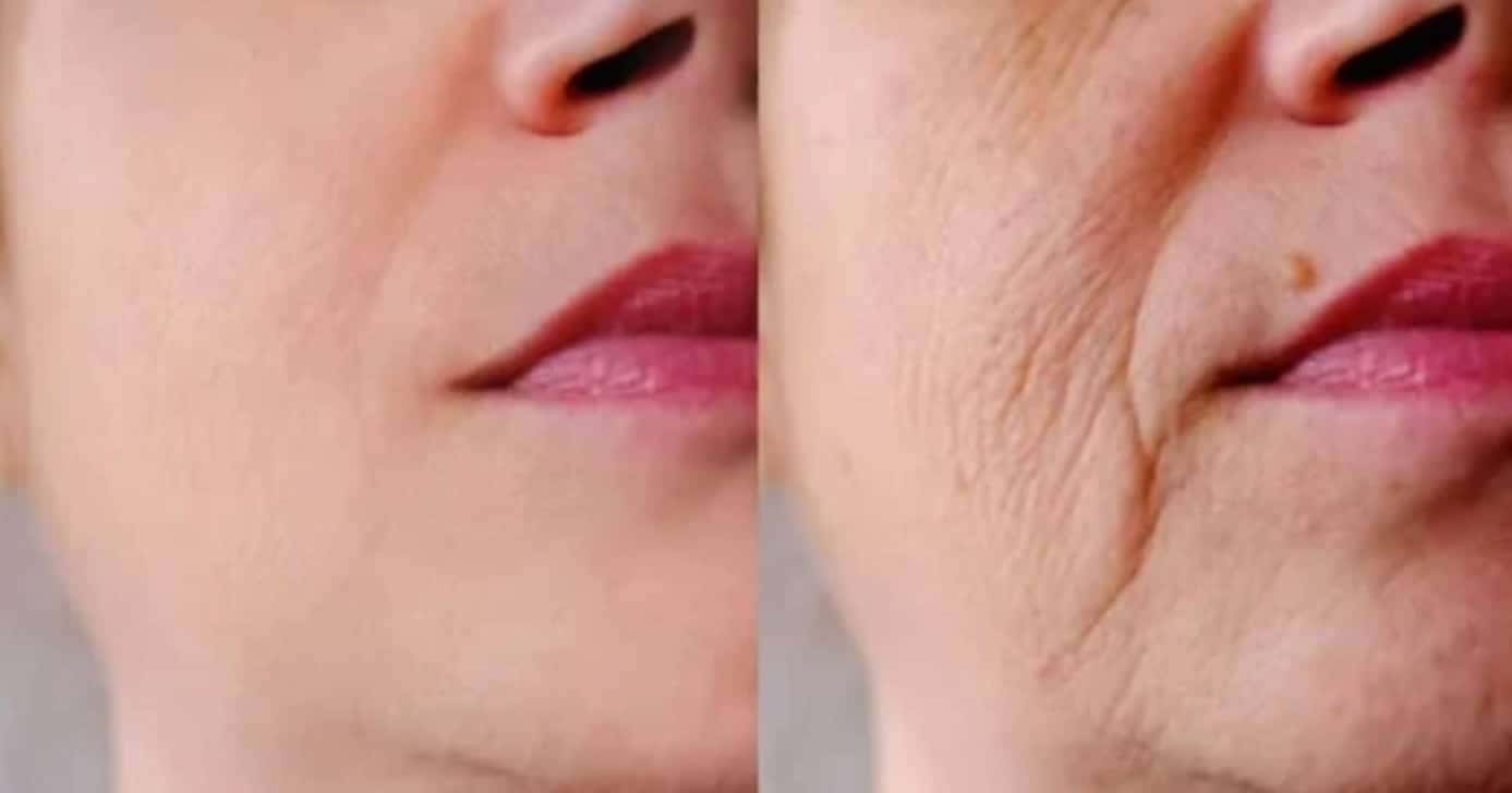 1 único ingrediente é capaz de reduzir rugas profundas e rejuvenescer mulheres 40+ - Foto: Internet