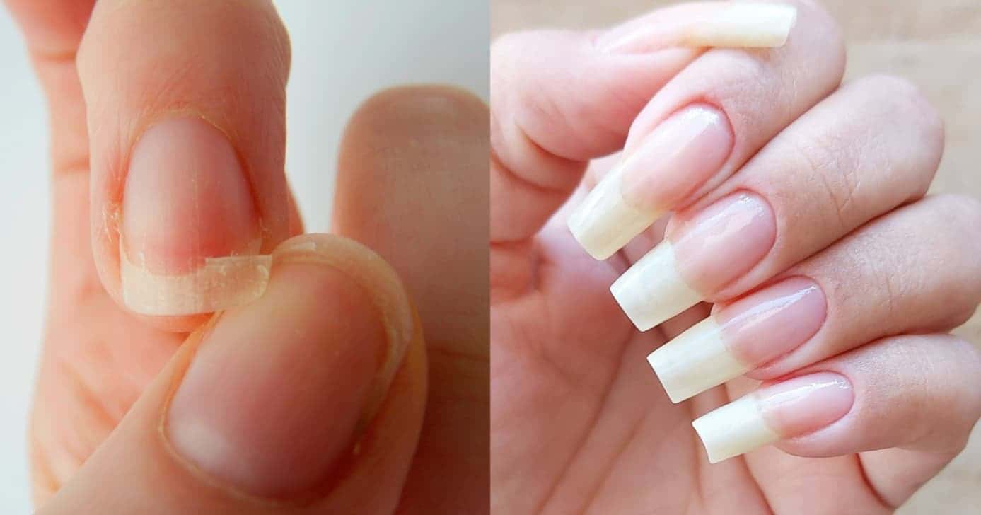 Alongamento em gel caseiro simples - (Montagem / TV FOCO)