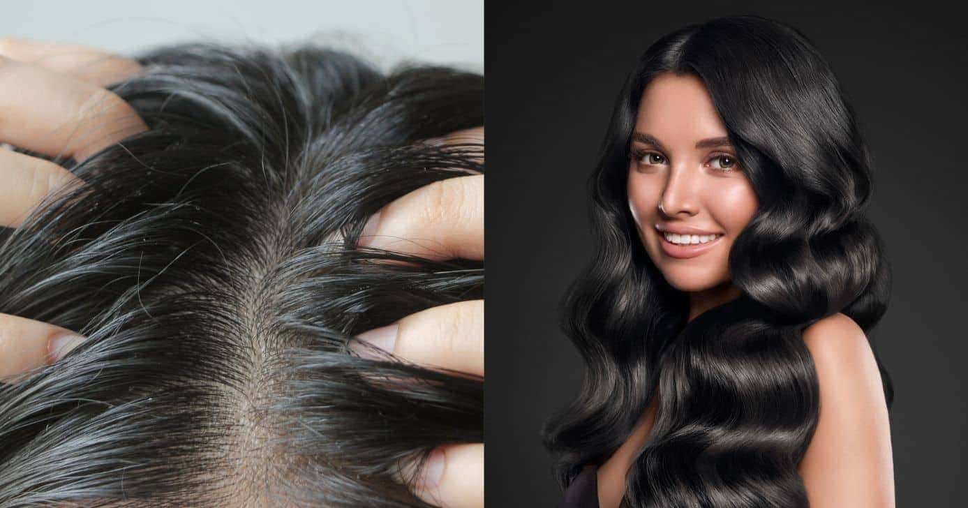 Cabelo oleoso e modelo (Fotos: Canva)