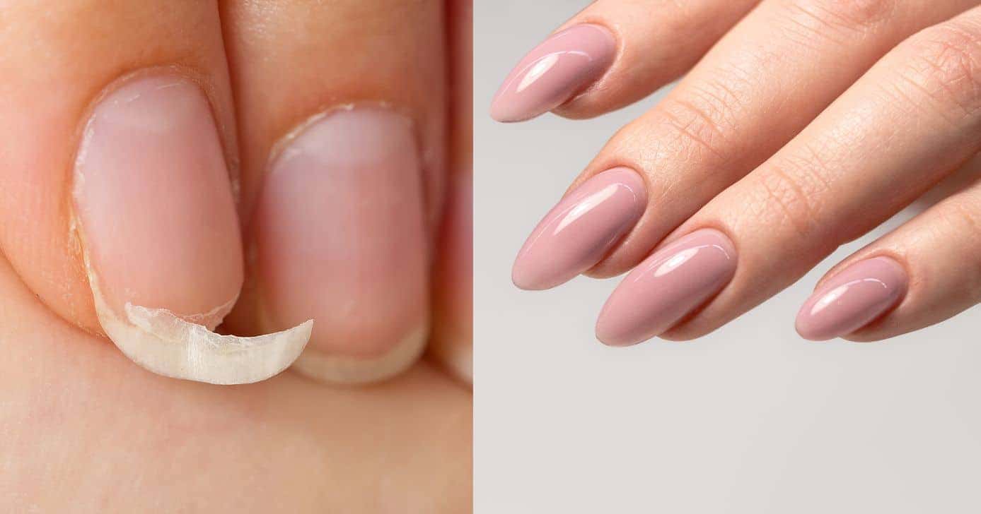 Unhas quebradas e com esmalte nude (Fotos: Canva)