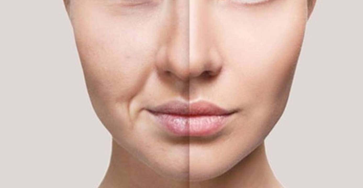 Com essa receita, você vai se livrar do bigode chinês (Foto: Divulgação)