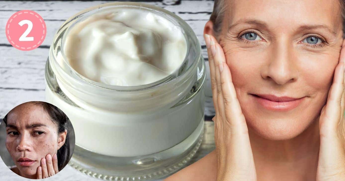Mulher com manchas e rugas e botox natural (Foto: Reprodução / Canva / Montagem TV Foco)