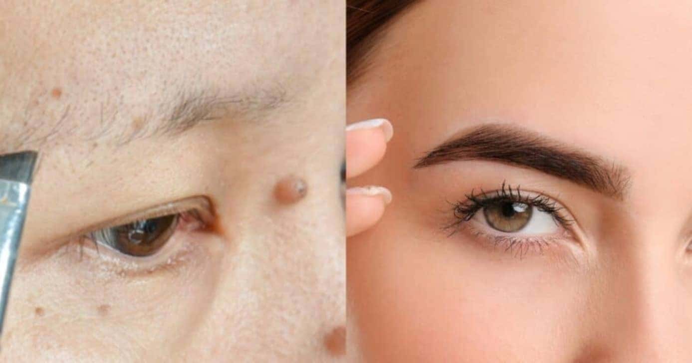 Mistura com 3 ingredientes deixa sobrancelhas grossas sem gastar 1 real - Foto: Internet