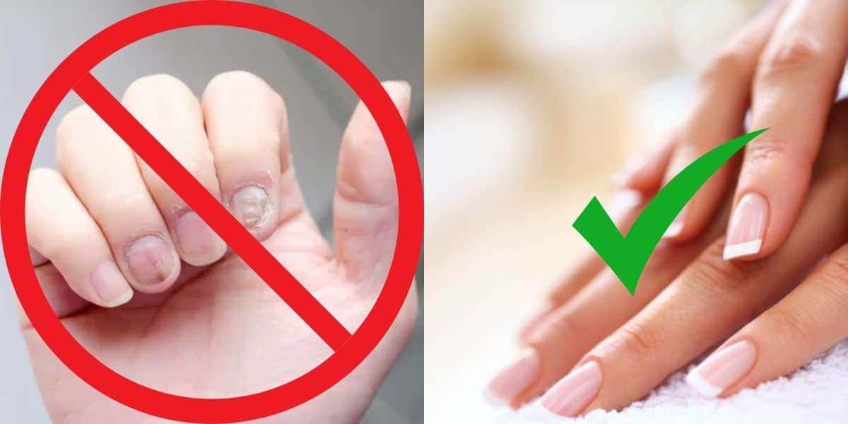 5 dicas para ter unhas gigantes e inquebráveis (Reprodução: Montagem TV Foco)