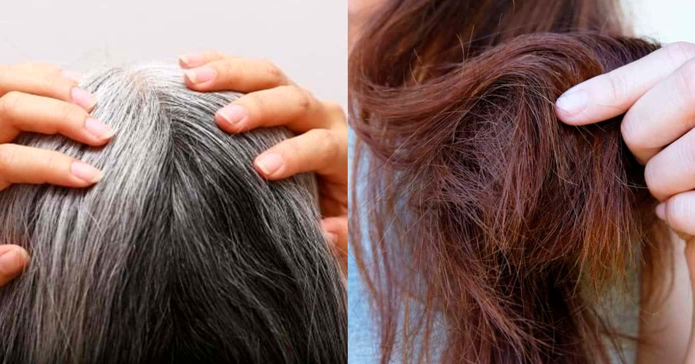 Cabelo branco e quebrado (Foto: Reprodução)