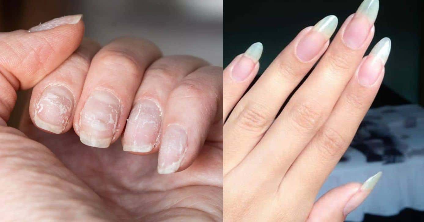 Unhas - Foto: Internet