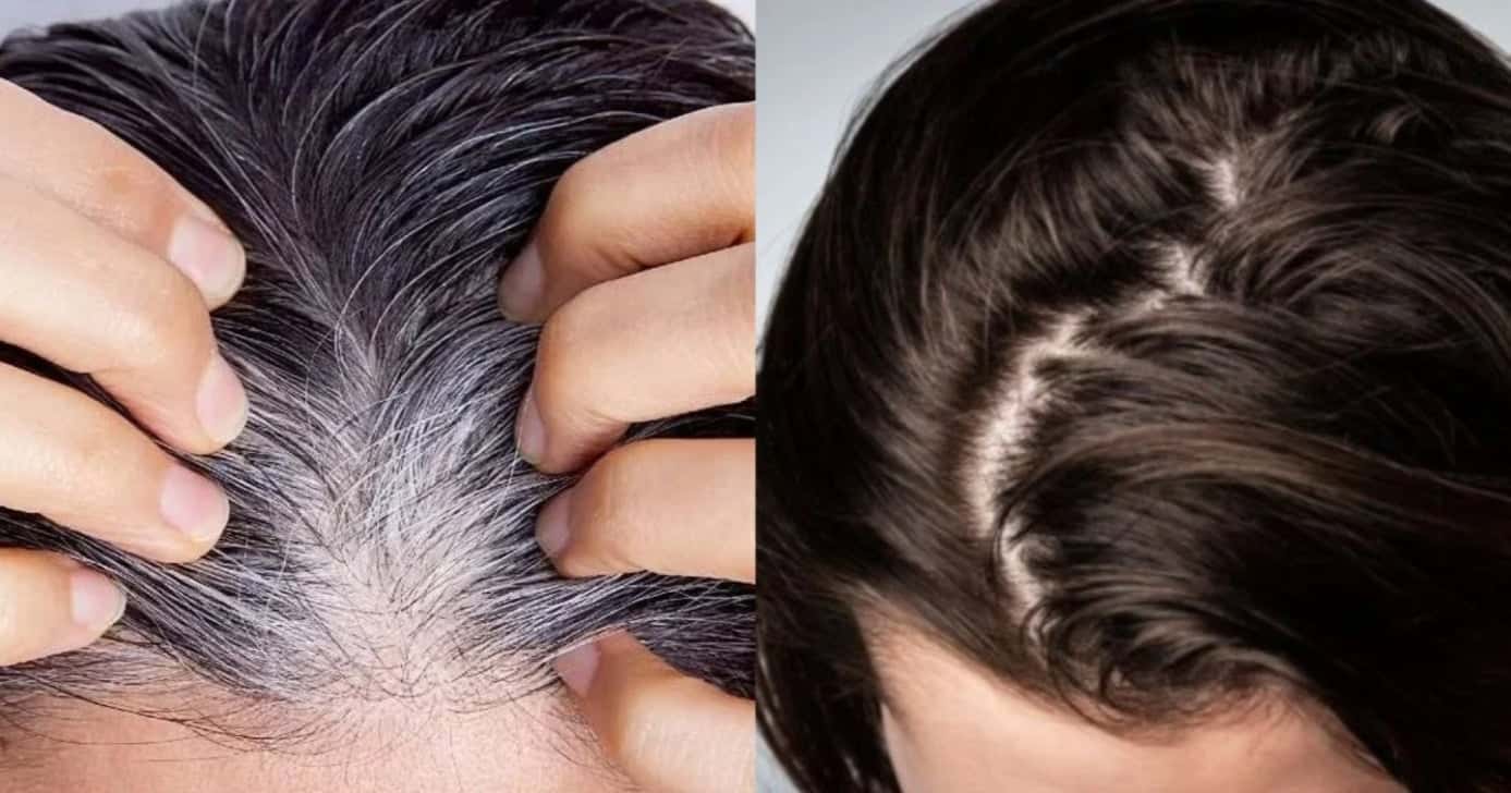 Tinta natural com 3 ingredientes populares faz mulheres 50+ ficarem mais jovem - (Montagem / TV FOCO)