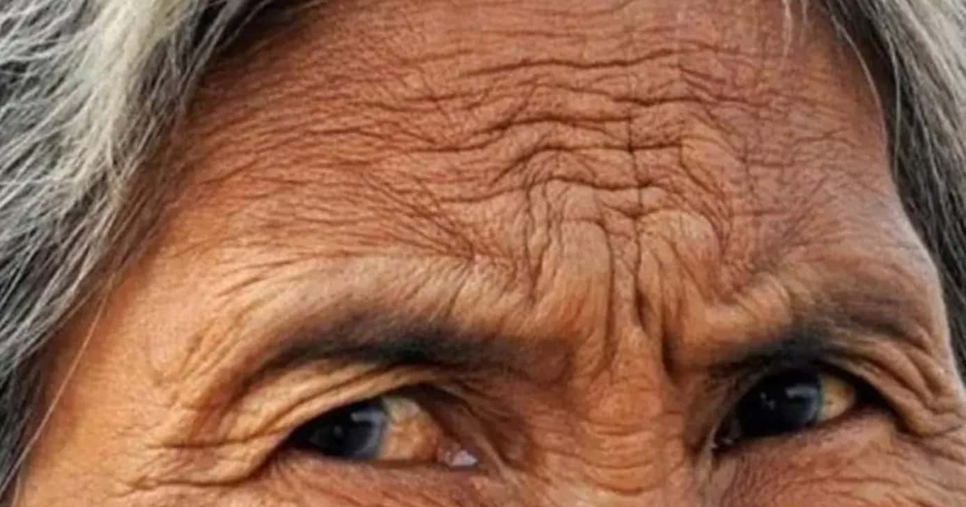 Essas atitudes estão destruindo totalmente o seu colágeno (Foto: Divulgação)