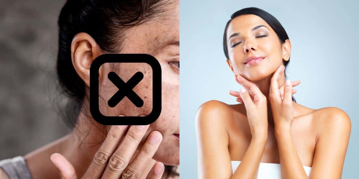 Fim das manchas na pele com receita de 3 ingredientes (Reprodução: Montagem TV Foco)