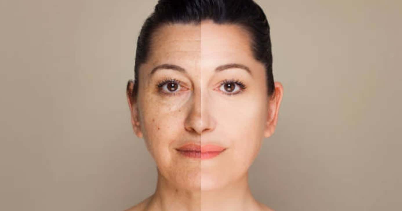 Harmonização facial caseira (Foto: Reprodução/Montagem TV Foco)