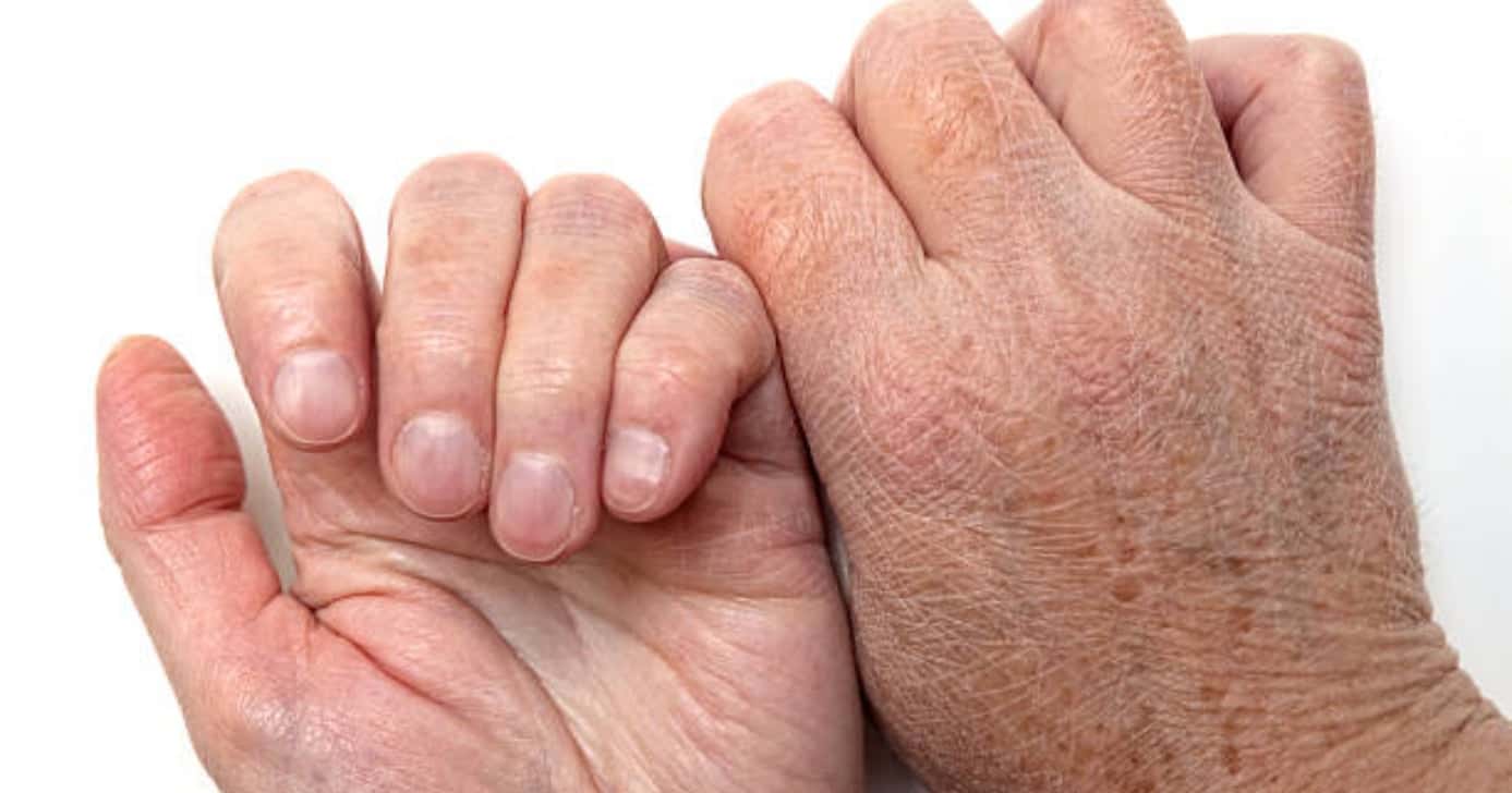 Mãos + jovens (Foto: iStock)