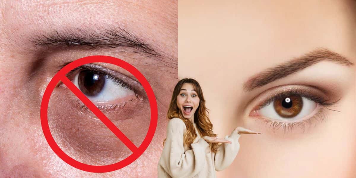 Fim das olheiras com 2 ingredientes naturais (Reprodução: Montagem TV Foco)