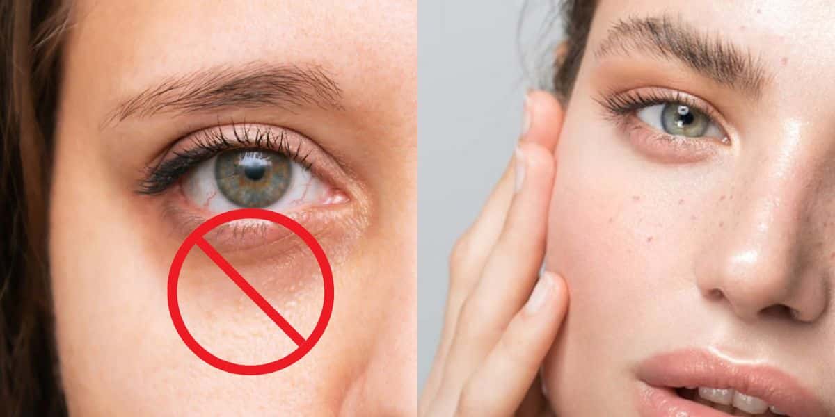 Fim das olheiras com 3 ingredientes caseiros (Reprodução: Montagem TV Foco)