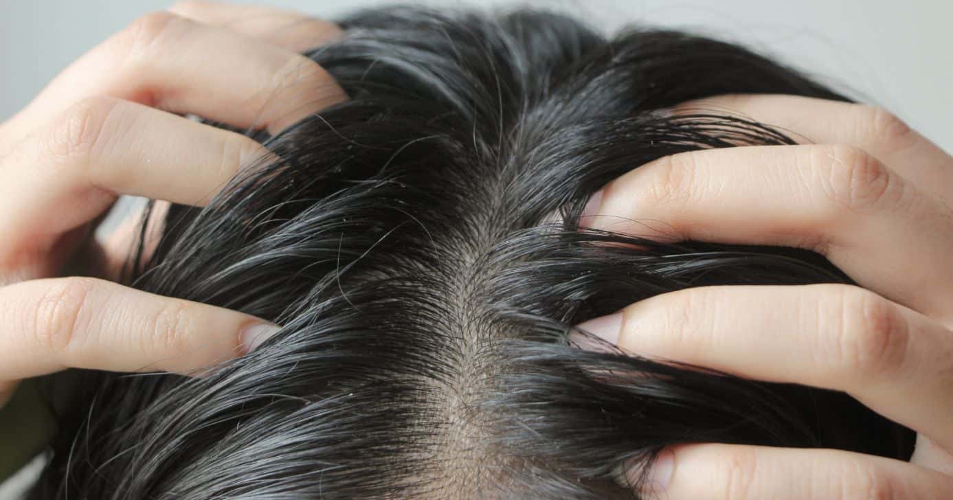 Cabelo oleoso (Foto: Canva)