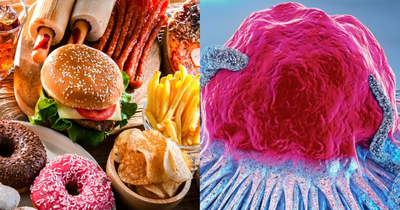 10 alimentos populares que aumentam o risco de câncer aos 50+ - Foto: Montagem