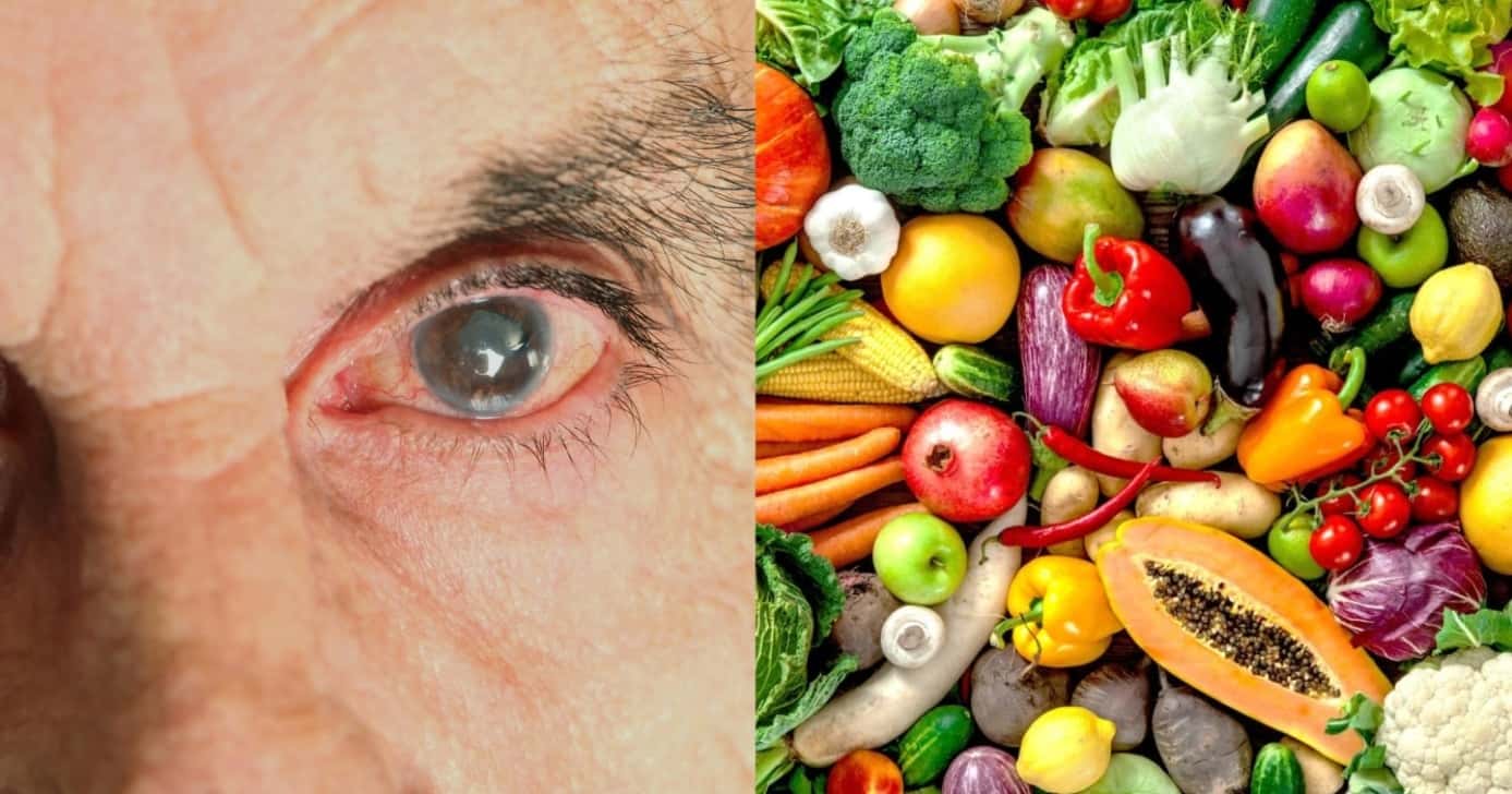 Especialista revela 6 alimentos para manter a saúde dos olhos - Foto: Montagem