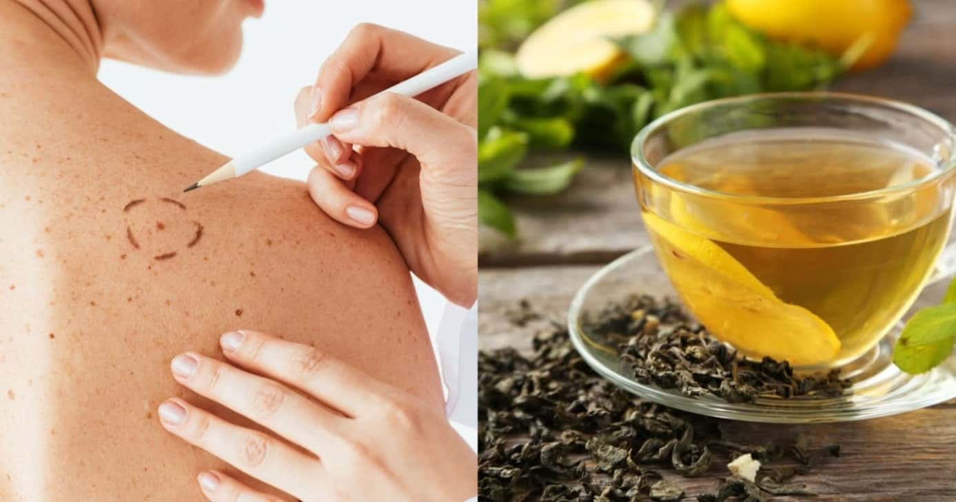 Esses são os 2 melhores chás para prevenir o câncer de pele - Foto: Montagem